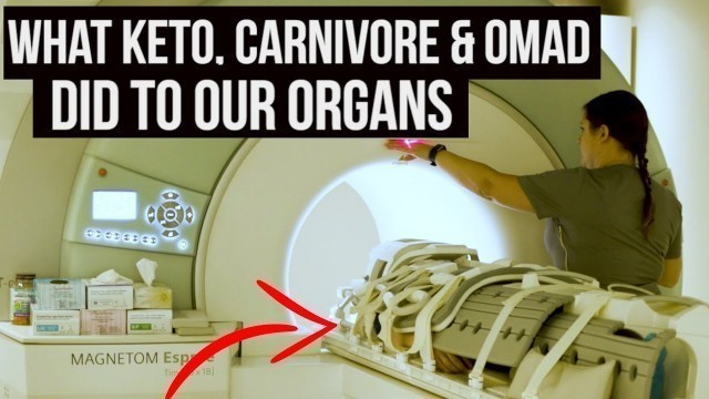 'Keto, Carnivore & OMAD Put to the Test {full body MRI scan}'