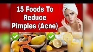 '✅15 Foods To Reduce Acne/Pimples || Best Foods To PREVENT ACNE'