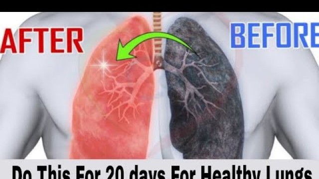 'Do This For 20 days For Healthy Lungs | 5 Simple Ways To Detox Your Lungs | Dr. Vivek Joshi'