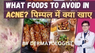 'पिंपल्स में क्या नहीं खाना चाहिए | Foods That Cause Pimples | Pimples me kya khaye ?'