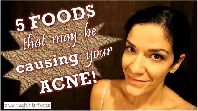 'ACNE CAUSING FOODS: 5 Foods that may be giving you pimples! - Clear Skin / Acne / Vegan / Skin Tips'