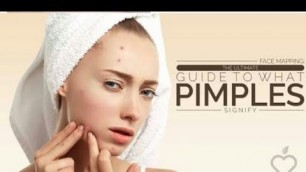 'Causes for pimples | causes for acne | food that cause acne |'