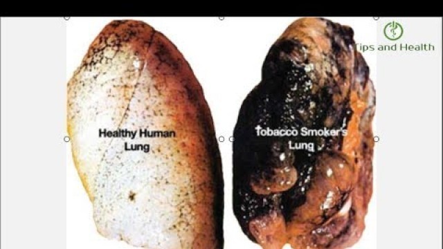 'Wow! 4 Foods That Will Clean Your Lungs And Save Your Life'