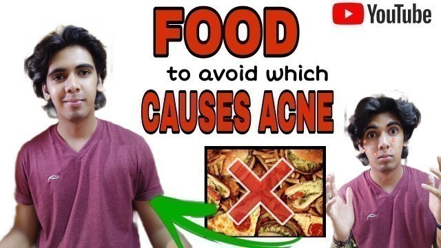 'FOOD to AVOID which causes ACNE | 10 beneficial food you should have | aditya lagad'