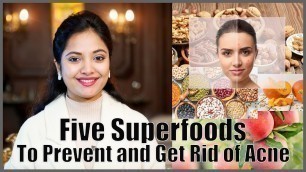 'Five Super Foods to Prevent and Get Rid of Acne'