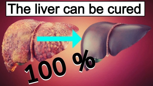 'Fatty liver diet: 7 best foods 