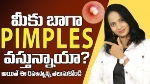 'Food That Causes Pimples || How to Get Rid Of Pimples || Home Remedy For Pimples |Health Tips Telugu'