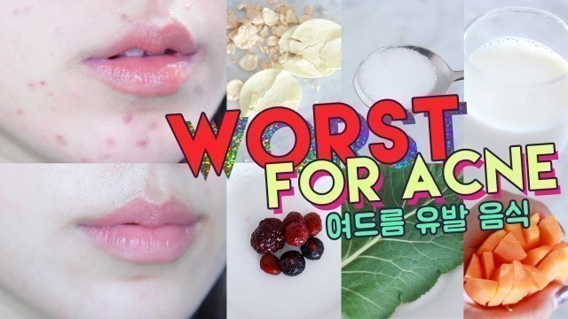 'WORST FOODS FOR ACNE! • Get Rid of Hormonal Acne Naturally 