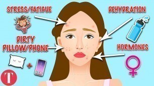 '10 Types Of Acne And What They Mean'