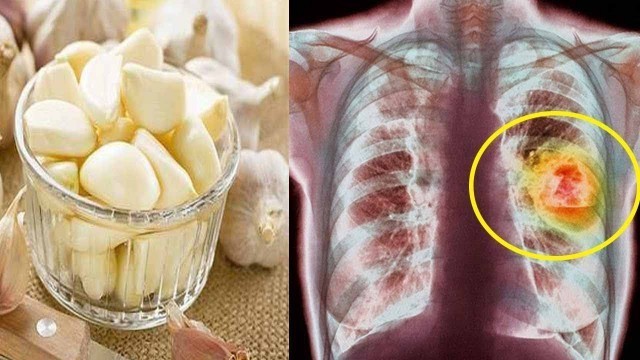 '15 Foods That Cleanse The Fastest For Lungs'