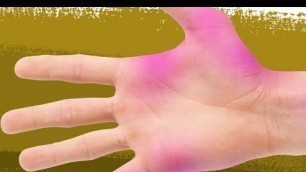 'How to remove food coloring stains from skin'