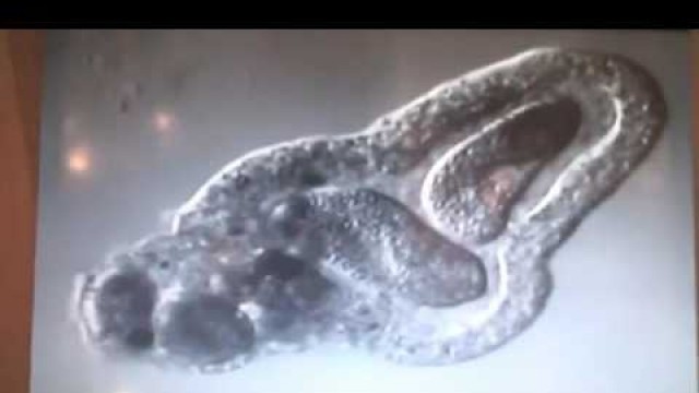 'Amoeba eats two paramecia Amoeba\'s lunch'
