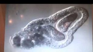'Amoeba eats two paramecia Amoeba\'s lunch'