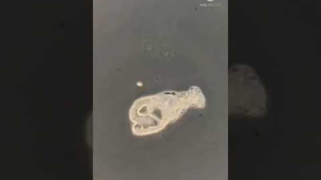 'How amoeba gets there food'