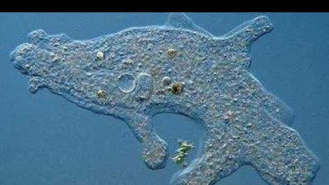 'Amoeba Eat Paramecium / Amoeba Hunt Paramecium Live 