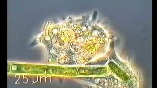 'Amoeba eating a green algae'