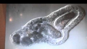 'Amoeba eats two paramecia (Amoeba\'s lunch)'