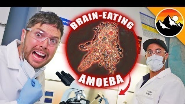 'I Caught Brain Eating Amoeba!'