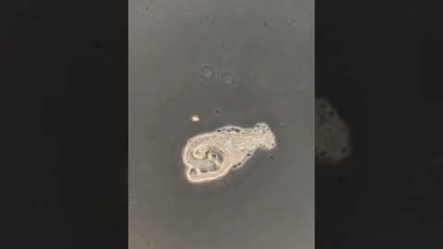 'Amoeba eating its food'