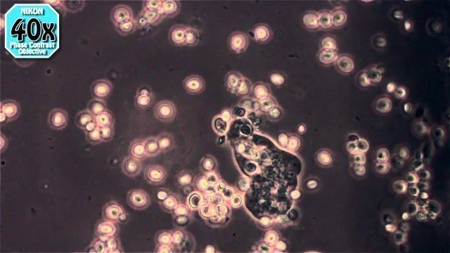 'Amoeba Eating Yeast'