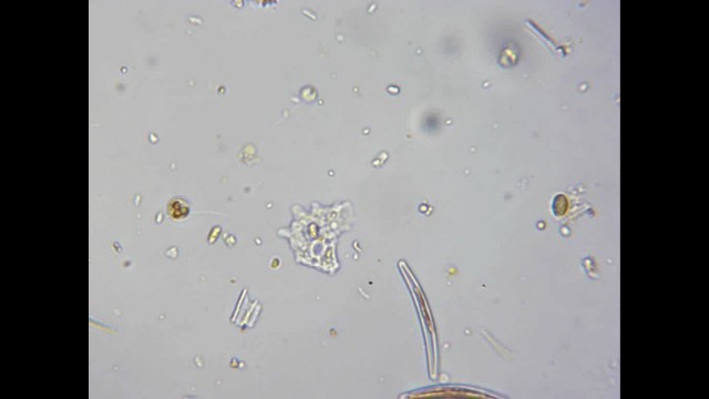 'Amoeba Eating ( species: Acanthamoeba ).avi'